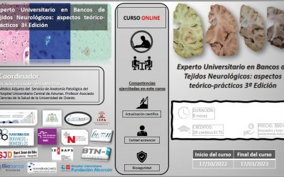 Abierto plazo preinscripción: TÍTULO DE EXPERTO EN BANCOS DE TEJIDOS NEUROLÓGICOS