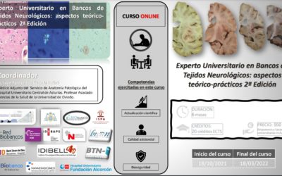 Anuncio: Título Propio Experto en Biobanco de Cerebros y Neuropatología