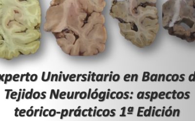 First edition of the Expert Course in Neurological Tissue Banks